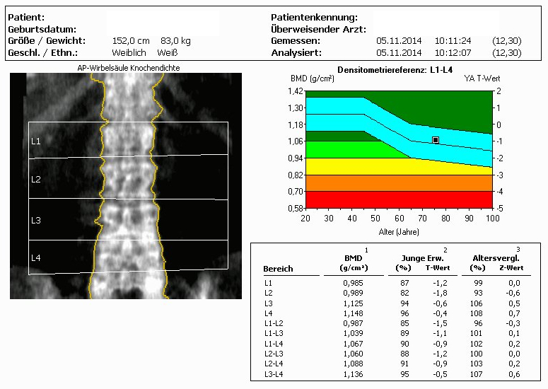 Osteodensitometrie LWS